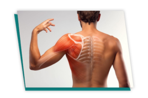 How Common Is Muscle Strain