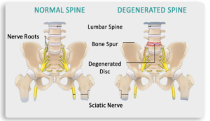 NORMAL SPINE