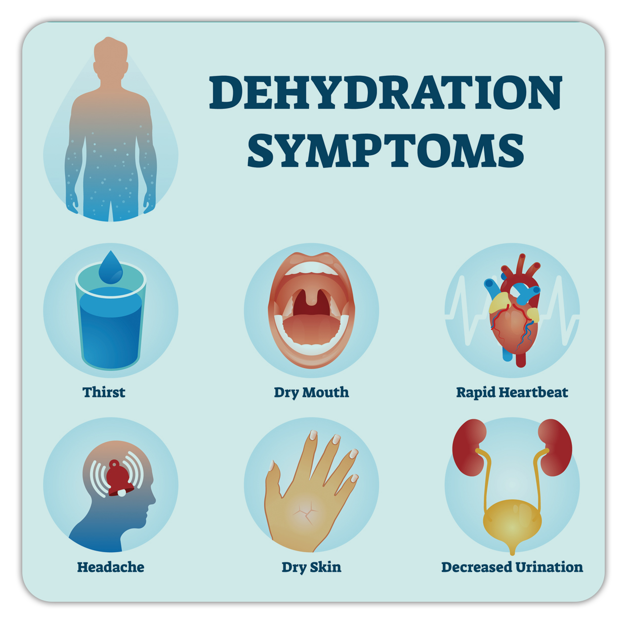 dehydration symptoms