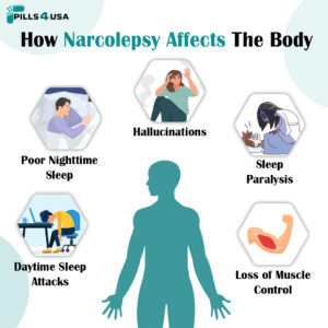 Narcolepsy 